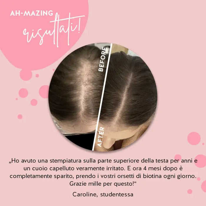 Vitamina Biotin Bear Benefits
